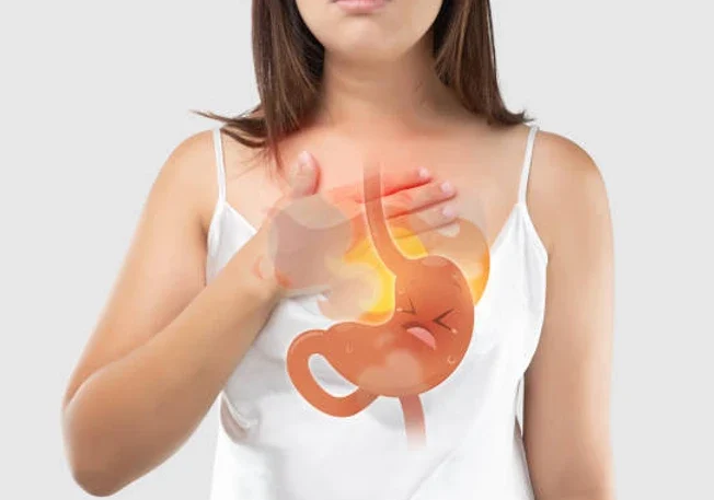 Gastroesophageal Reflux Disease: Oh dear GORD