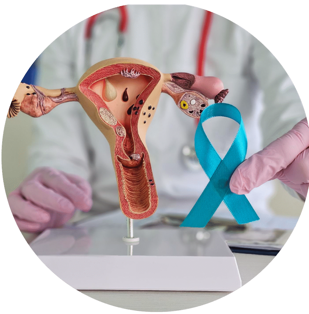 Institute of Gynaec Oncology in Mysore – avantbkg hospitals