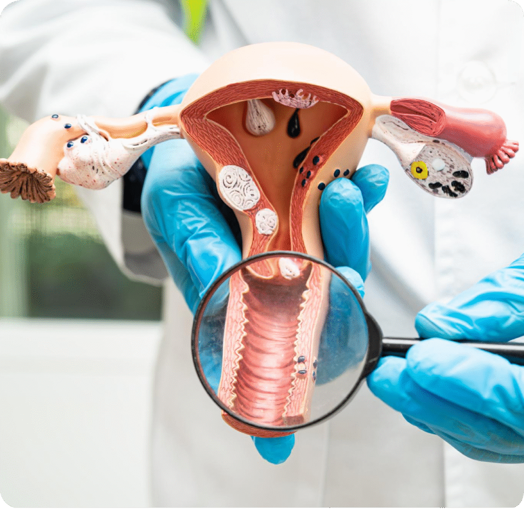 Institute of Gynaec Oncology in Mysore – avantbkg hospitals