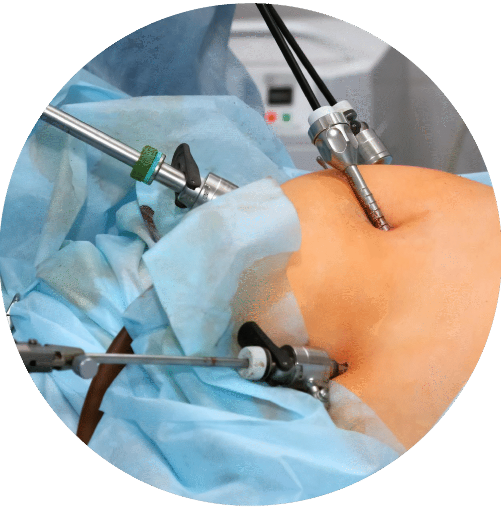 Surgical Gastroenterology Hospital in Mysore – avantbkg hospitals