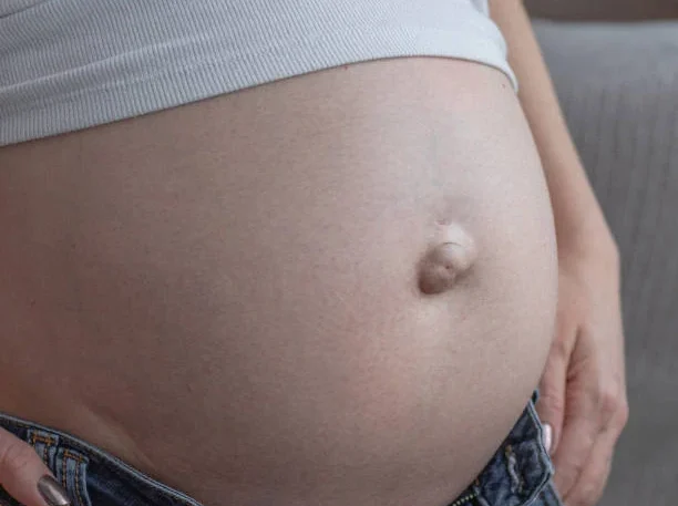 Hernia: a bulge that shouldn’t be there