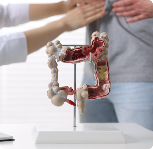 Best Gastroenterology Hospital in Mysore – avantbkg hospitals