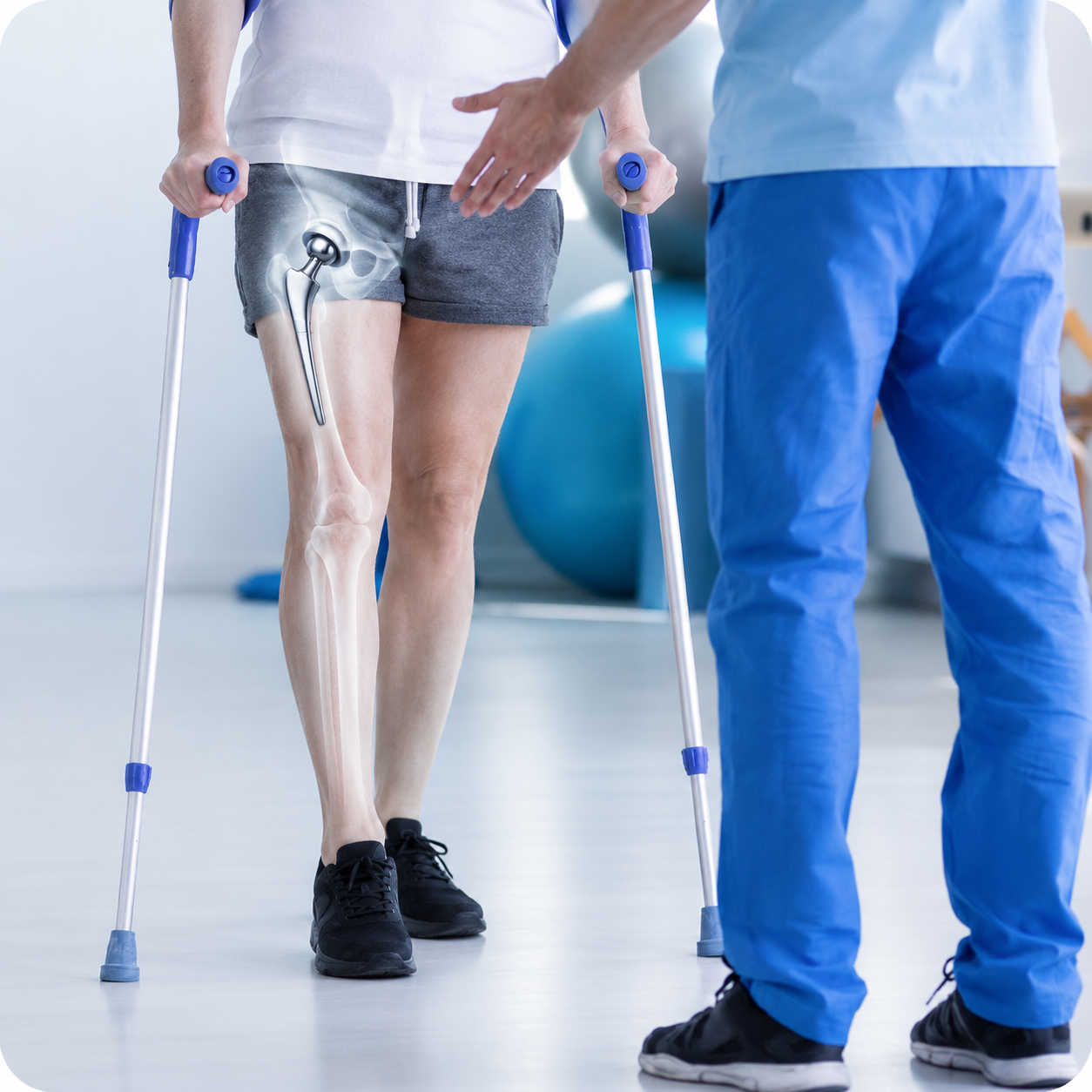 Total Hip Replacement Surgery